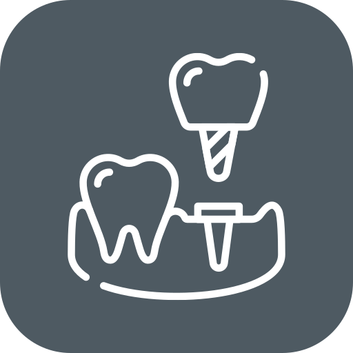 dental implant