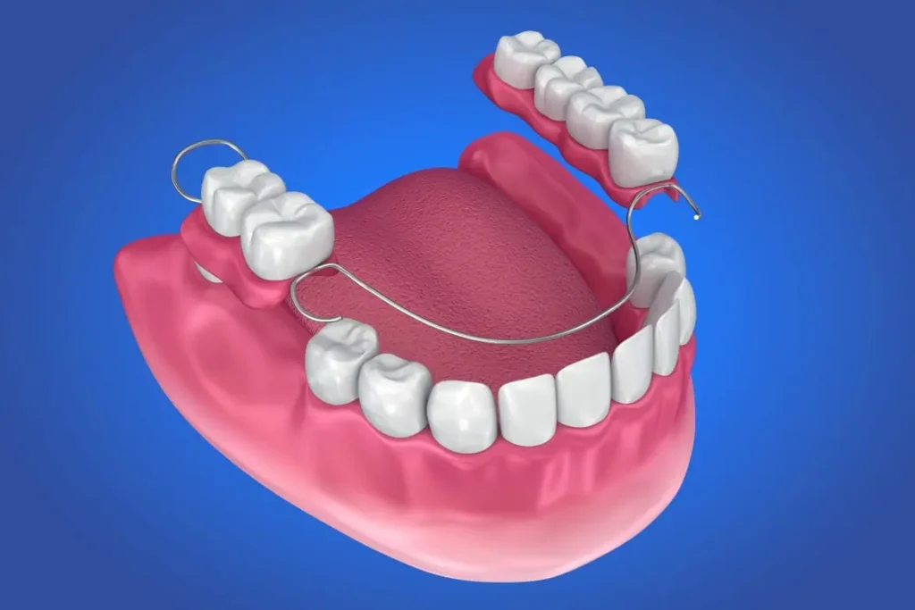 dental services at mikael dental