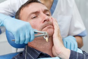 Wisdom tooth remove
